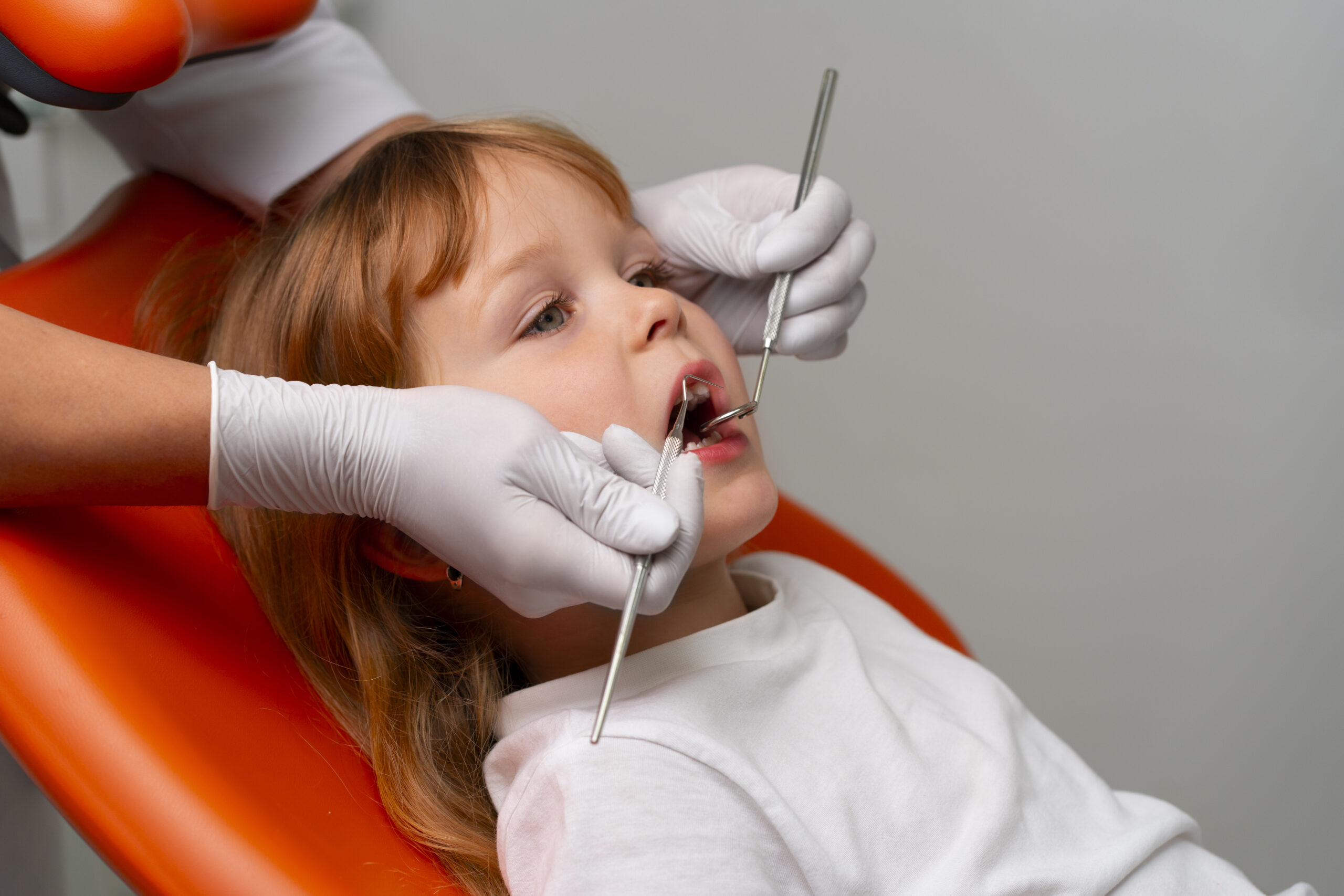 The Role of Dental Sealants in Preventing Cavities in Kids