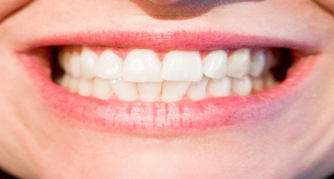 The Pros and Cons of Porcelain Veneers: Are They Right for You?