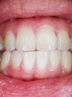 Periodontal Disease and Its Link to Systemic Health: Why Treating Gum Disease is Crucial